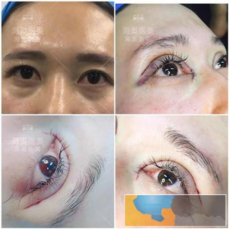 营口微整形培训学校榜 营口微整形培训学校榜