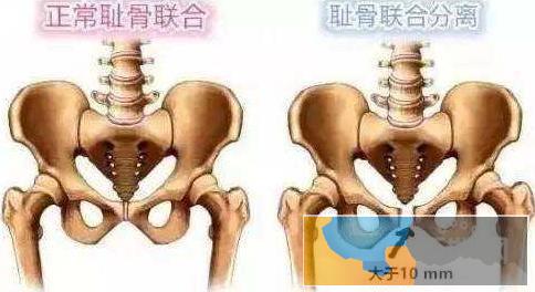 珠海市月嫂 催乳师育婴 产后恢复培训考证包就业