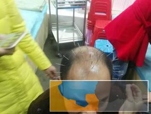 吴忠报名学中医针灸推拿多少钱 免费试学 考取证书