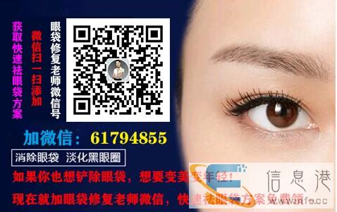 如何消除眼袋变得迷人 去除眼袋的办法有哪些个